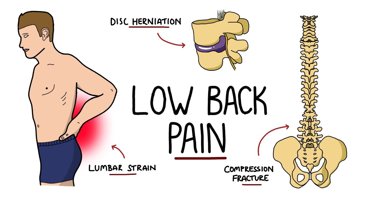 Lower Back Pain Treatment Clinic